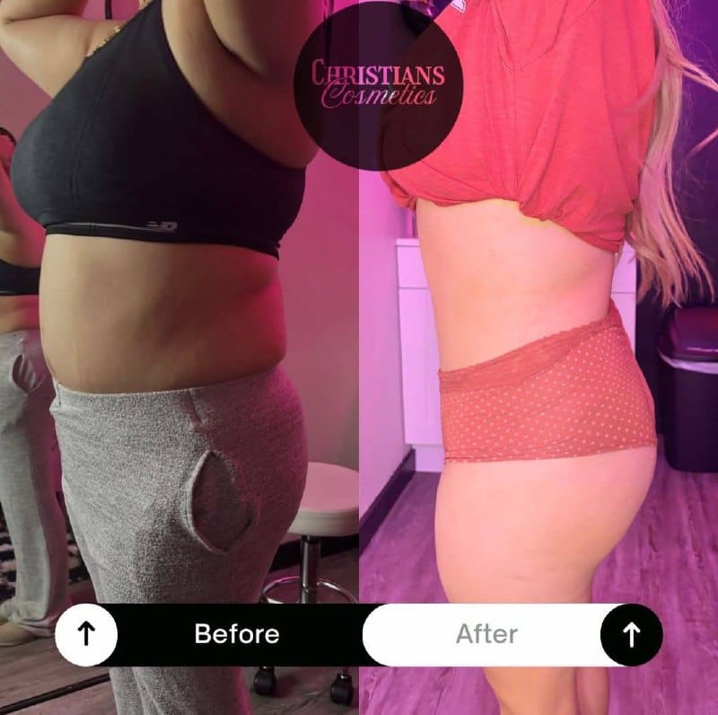 Before and after result 1