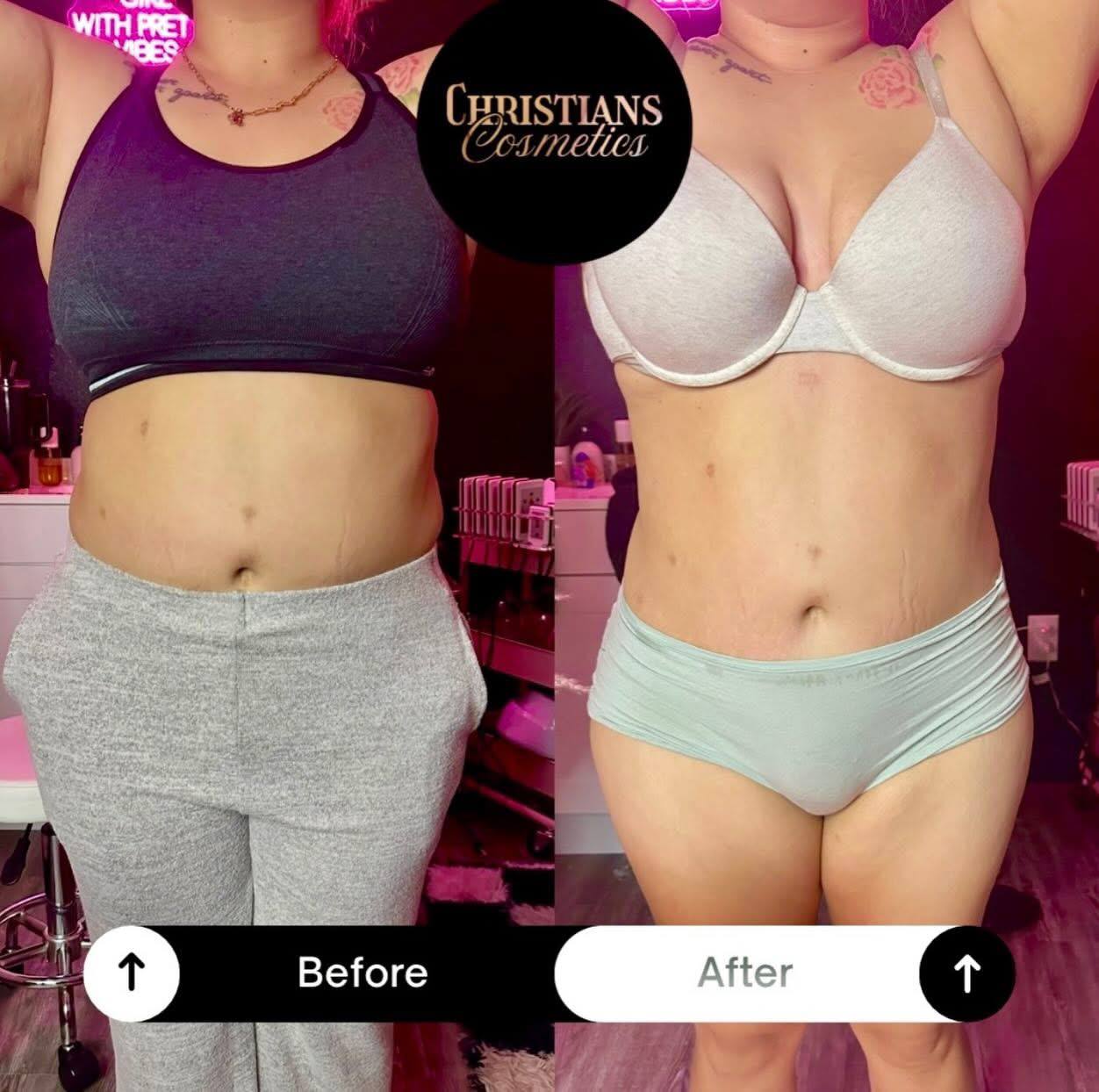 Before and after result 2